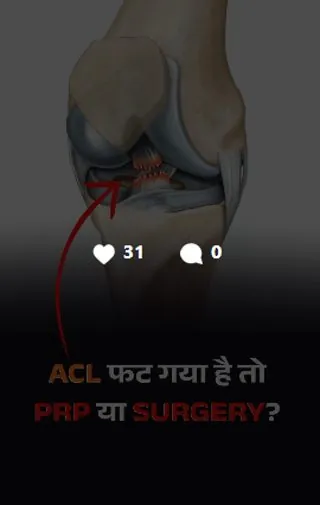 Reel: torn ACL — PRP or surgery