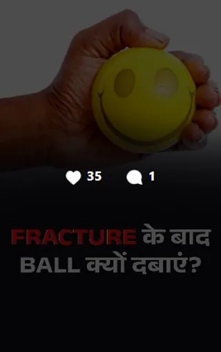 Reel: why squeeze a ball after a fracture
